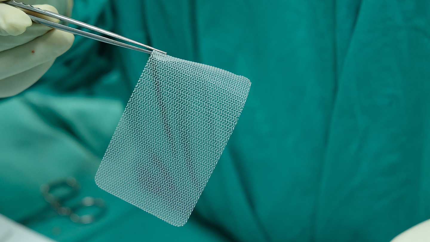 Photo of a surgeon holding hernia mesh